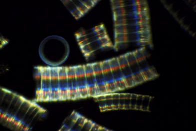 Una diatomea vista al microscopio