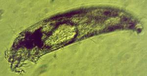 Colomerus Vitis, un ácaro que provoca erinosis en la vid