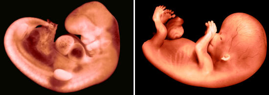 A la izquierda un embrión humano de 30 días; a la derecha el mismo embrión con 56 días donde ya se aprecian claramente cuerpo, cabeza y extremidades