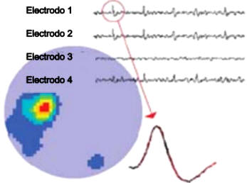 Cuatro electrodos de registro dentro del hipocampo revelan impulsos nerviosos en dos de ellos (1 y 2, ocasionalmente 4) que representan neuronas disparando en respuesta a un lugar determinado (punto rojo dentro del círculo amarillo). Aumentando la escala del tiempo (círculo rojo) vemos representado la forma del impulso en el cerebro.