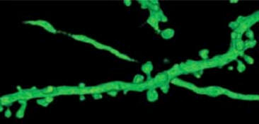Las espinas dendríticas son las pequeñas protuberancias que emergen de las dendritas en verde. Aquí es donde se localizan las sinapsis